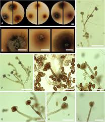 Attēlu rezultāti vaicājumam “Badhamia versicolor spores”