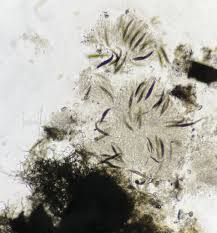 Attēlu rezultāti vaicājumam “Diderma ochraceum spores”