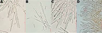 Attēlu rezultāti vaicājumam “Lachnum corticale”