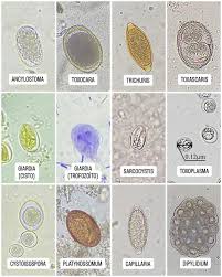 Attēlu rezultāti vaicājumam “Blepharostoma trichophyllum sporophyte”