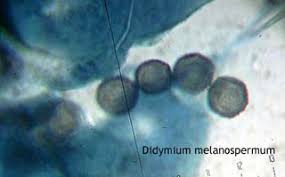 Attēlu rezultāti vaicājumam “Didymium tussilaginis”