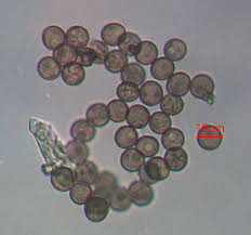 Attēlu rezultāti vaicājumam “Physarum pseudoalexandrowiczii”