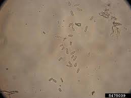 Attēlu rezultāti vaicājumam “Licea castanea spores”