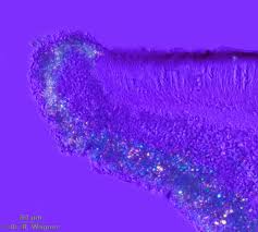 Attēlu rezultāti vaicājumam “Lecanora allophana”