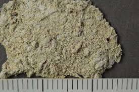 Attēlu rezultāti vaicājumam “Pertusaria coccodes”