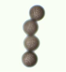 Attēlu rezultāti vaicājumam “Diderma simplex sessile”