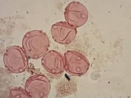 Attēlu rezultāti vaicājumam “Haloragaceae”