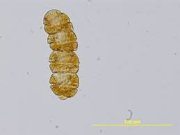 Attēlu rezultāti vaicājumam “Didymium crustaceum macro”