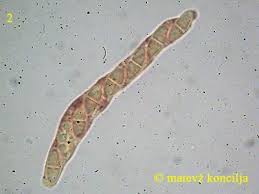 Attēlu rezultāti vaicājumam “Nectria episphaeria”