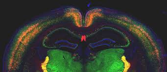 Image result for maralaser tehron