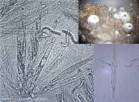 Attēlu rezultāti vaicājumam “Lasiosphaeria ovina spores”