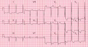 Image result for  ^ L V [ h    