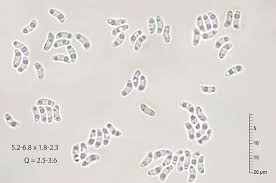 Attēlu rezultāti vaicājumam “Rhodonia placenta”