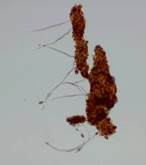 Attēlu rezultāti vaicājumam “Physarum decipiens spores”