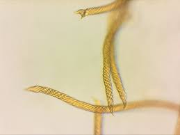 Attēlu rezultāti vaicājumam “Oligonema favogineum”