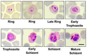 Attēlu rezultāti vaicājumam “Didymium spongiosum plasmodium”