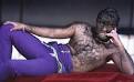 HairWeb.org • Hair diseases: Hypertrichosis, Trichotillomania ...