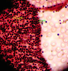 Attēlu rezultāti vaicājumam “Cribraria tenella stalked”