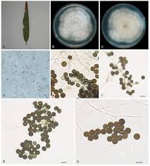 Attēlu rezultāti vaicājumam “Stemonitopsis aequalis var. microspora spores”