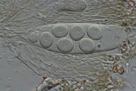 Attēlu rezultāti vaicājumam “Trichia contorta spores”