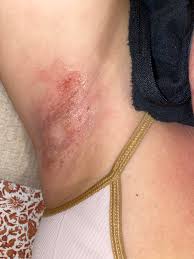 Image result for armpits are fine too