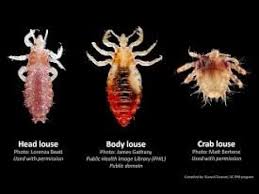 Attēlu rezultāti vaicājumam “Pediculus humanus capitis”