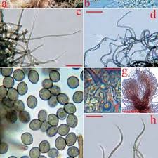 Attēlu rezultāti vaicājumam “Diderma globosum spores”