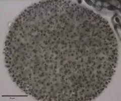 Attēlu rezultāti vaicājumam “Gloeocapsa rupestris”