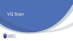 Image result for  v    q