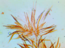 Attēlu rezultāti vaicājumam “Ruzenia spermoides”