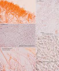 Attēlu rezultāti vaicājumam “Cinereomyces lindbladii”