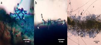 Attēlu rezultāti vaicājumam “Lycogala asperum”