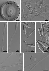 Attēlu rezultāti vaicājumam “Orbilia sp.”