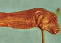 (<b>maladies vaginales</b>)