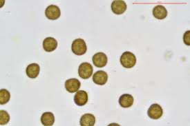Attēlu rezultāti vaicājumam “Physarum penetrale spores”