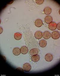 Attēlu rezultāti vaicājumam “Badhamiopsis scripta”