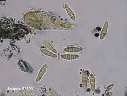 Attēlu rezultāti vaicājumam “Opegrapha atra”