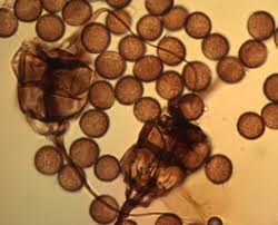 Attēlu rezultāti vaicājumam “Brefeldia maxima macro”