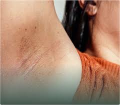 Image result for armpits are fine too