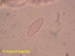 Attēlu rezultāti vaicājumam “Lachnellula willkommii”