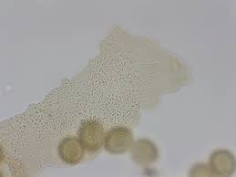 Attēlu rezultāti vaicājumam “Hemitrichia karstenii plasmodium”