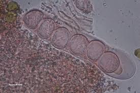 Attēlu rezultāti vaicājumam “Trichia contorta spores”