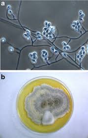 Attēlu rezultāti vaicājumam “Stemonitopsis aequalis var. microspora”