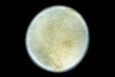 Attēlu rezultāti vaicājumam “Nostoc pruniforme”