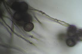 Attēlu rezultāti vaicājumam “Didymium squamulosum spores”