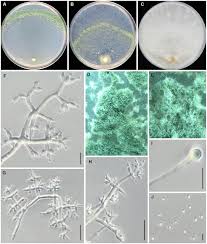 Attēlu rezultāti vaicājumam “Comatricha elegans var. microspora spores”