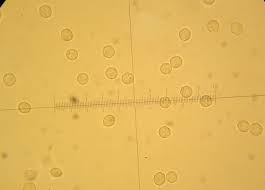 Attēlu rezultāti vaicājumam “Arcyria denudata spores”