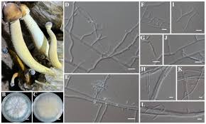 Attēlu rezultāti vaicājumam “Fuligo gyrosa spores”