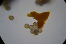 Attēlu rezultāti vaicājumam “Physarum alexandrowiczii spores”