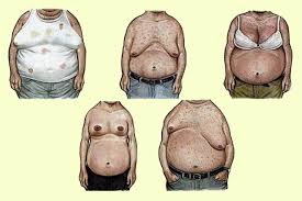 Image result for manboobs